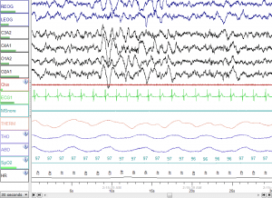 sleep_stage_n3