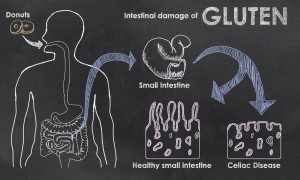 Intestinal Damage of Gluten