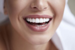 veneers confident smile